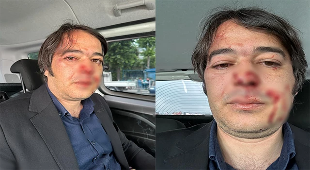 İBB Ekiplerine saldırı